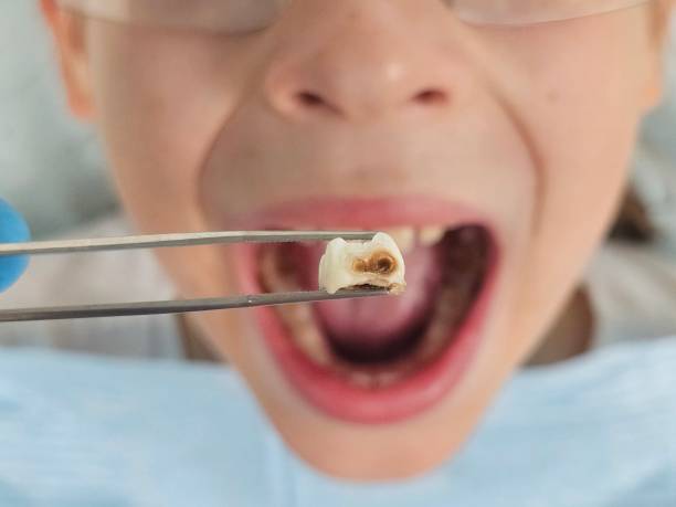 Best Cosmetic Emergency Dentistry in Albion, NY